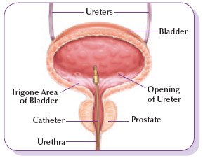 BCG_Bladder