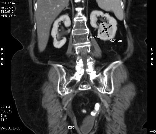 laparoscopic x-ray of kidneys and bladder